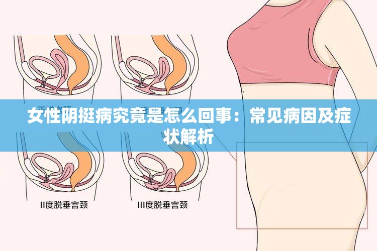 女性阴挺病究竟是怎么回事：常见病因及症状解析